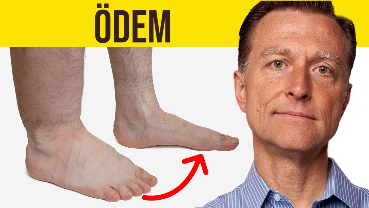 Ödemin Sekiz Nedeni | Dr.Berg Türkçe
