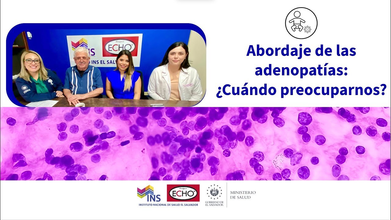 Abordaje de las adenopatías: ¿Cuándo preocuparnos?