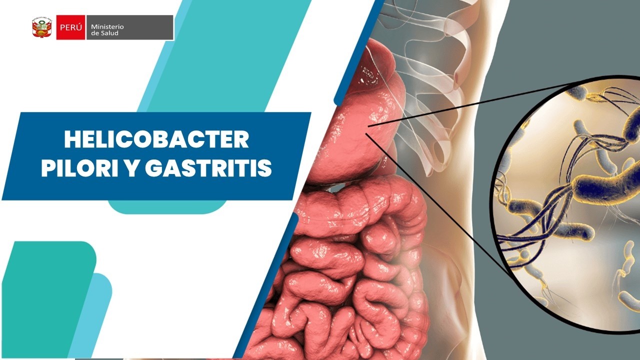 HELICOBACTER PILORI Y GASTRITIS