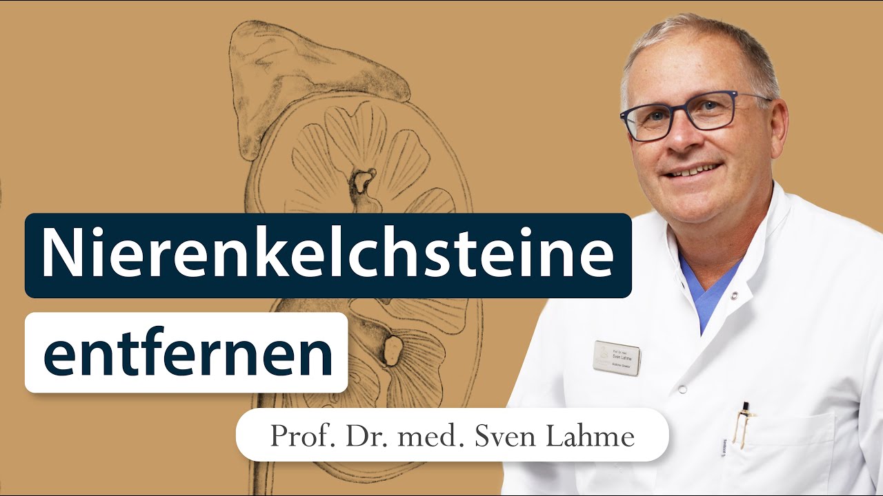 Nierenkelchsteine entfernen: Alles Wissenswerte zur endoskopischen Behandlung