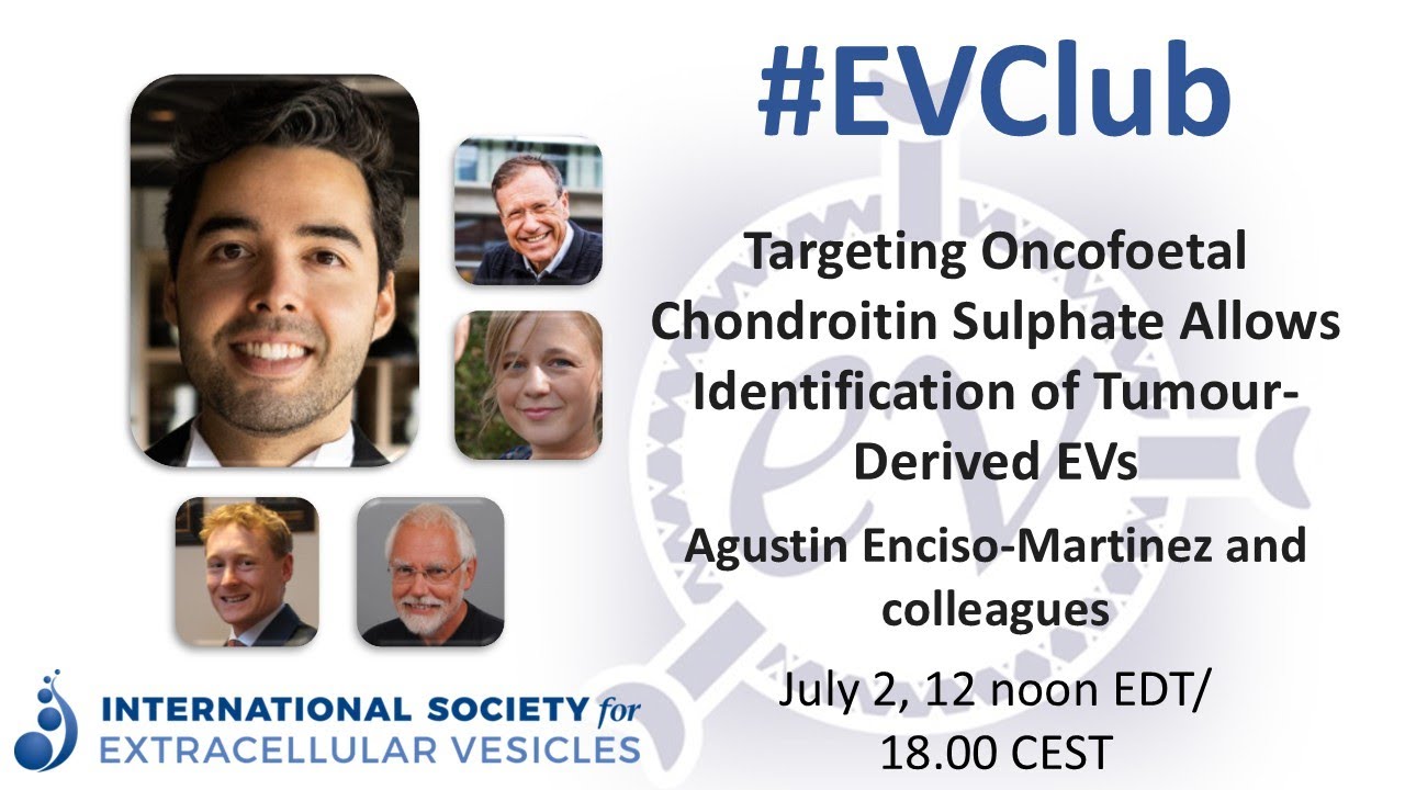 Agustin Enciso-Martinez: Oncofoetal Chondroitin Sulphate identifies tumour EVs