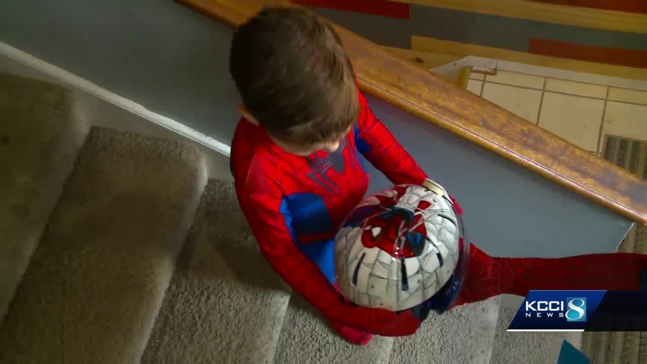 5-year-old's 'spidey senses' restored with specially designed helmet