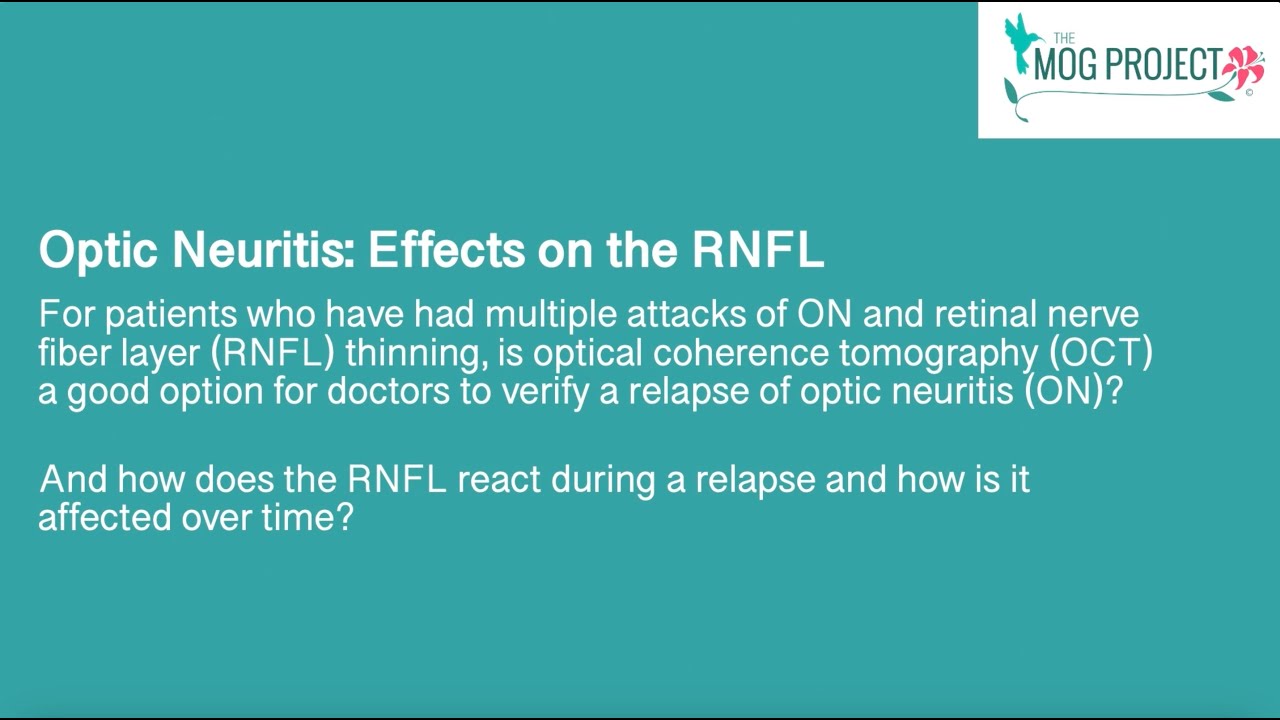 Optic Neuritis: Effects on the RNFL