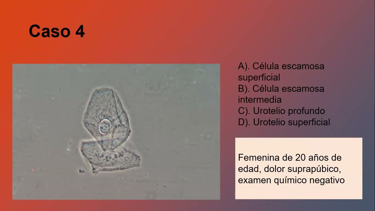 IDENTIFICACION DE CELULAS EN EL SEDIMENTO URINARIO - Ven a probar tus conocimientos