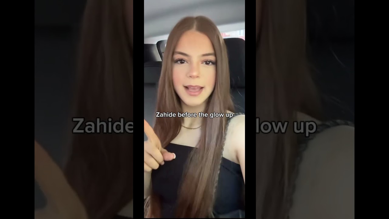 Zahide before the glow up💕 #zahide #edit #glowup