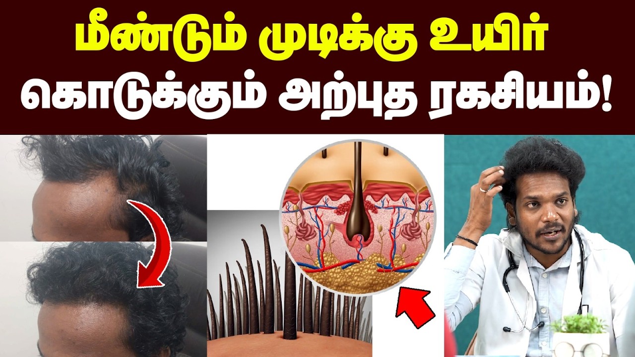 Hair Fall தீர்வு : இதெல்லாம் பண்ணா செம்மையா முடி வளரும்🔥| Hairloss | Hair care in tamil| Hair Loss