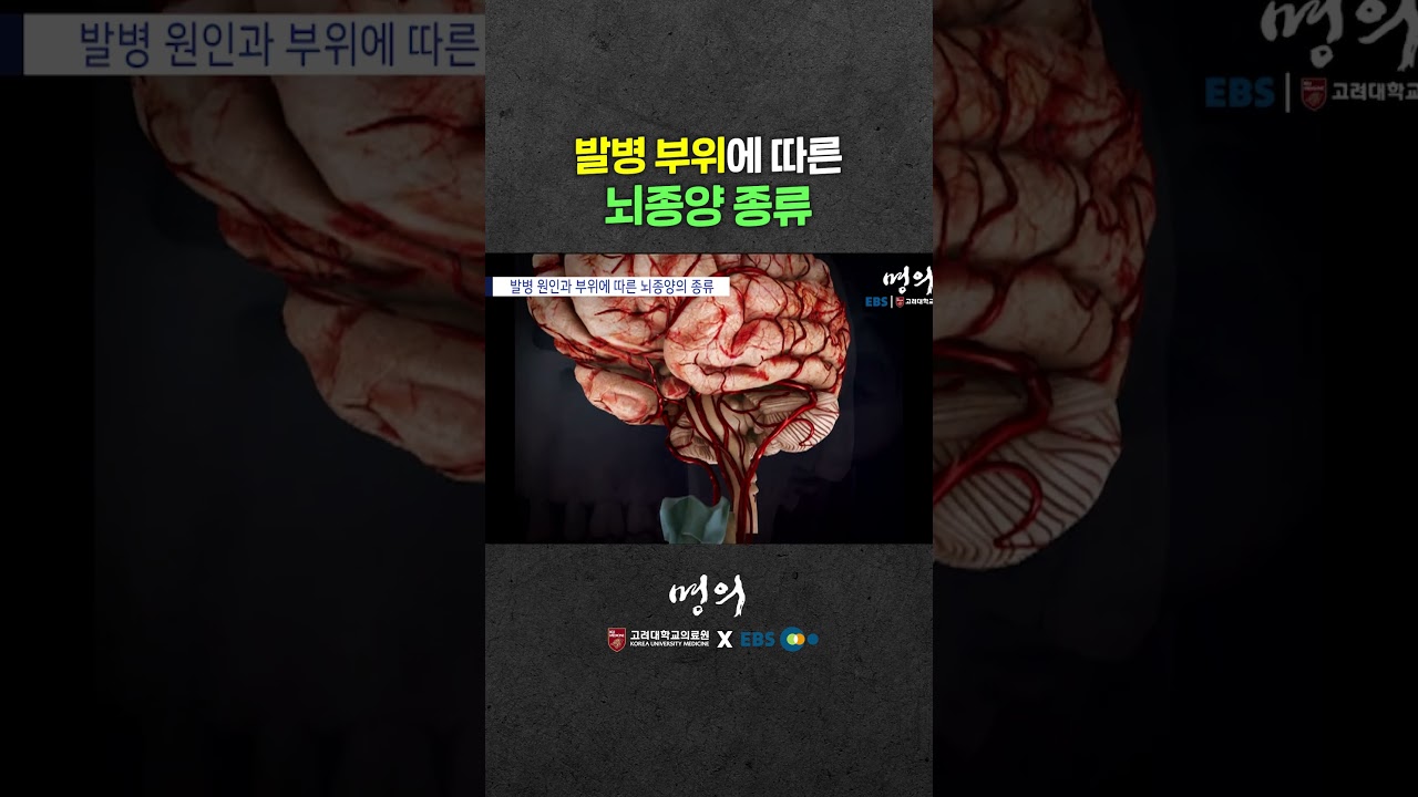 양성 뇌종양? 악성 뇌종양? 뇌종양의 종류