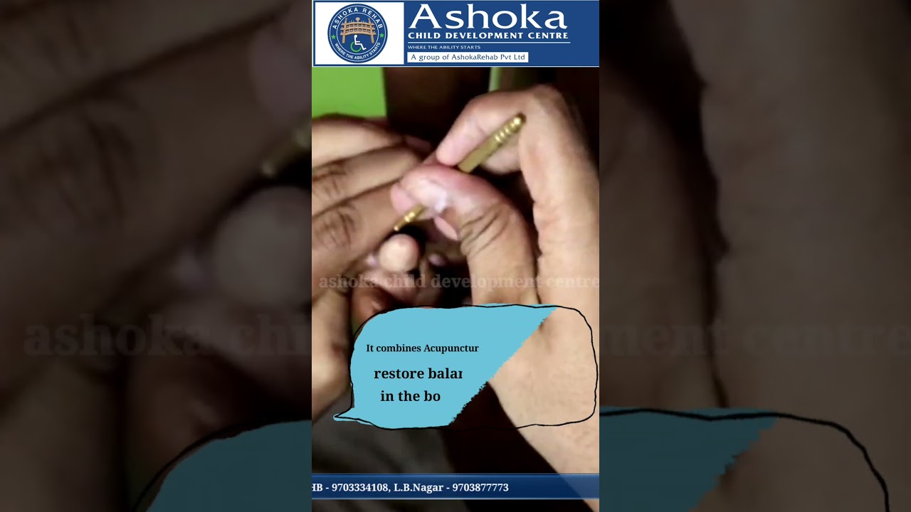 Sujok Sixki Therapy In Ashoka Child Development Centre #sujok