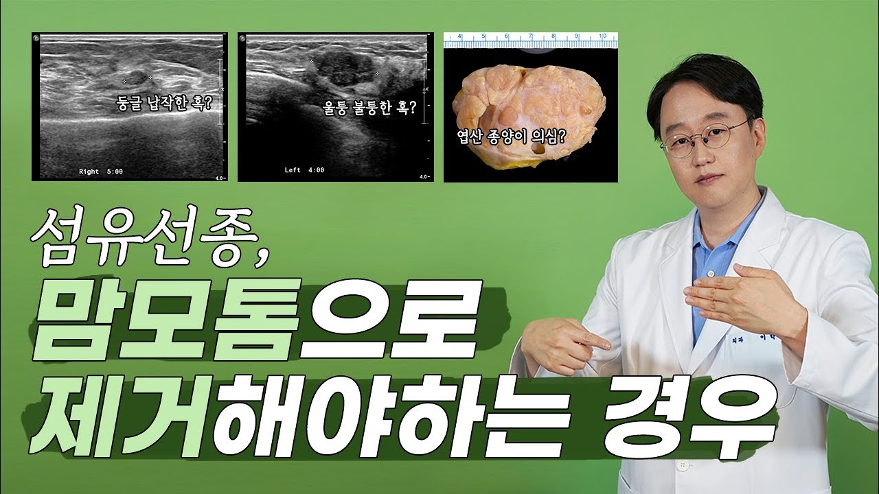 섬유선종, 맘모톰으로 제거해야 하는 경우