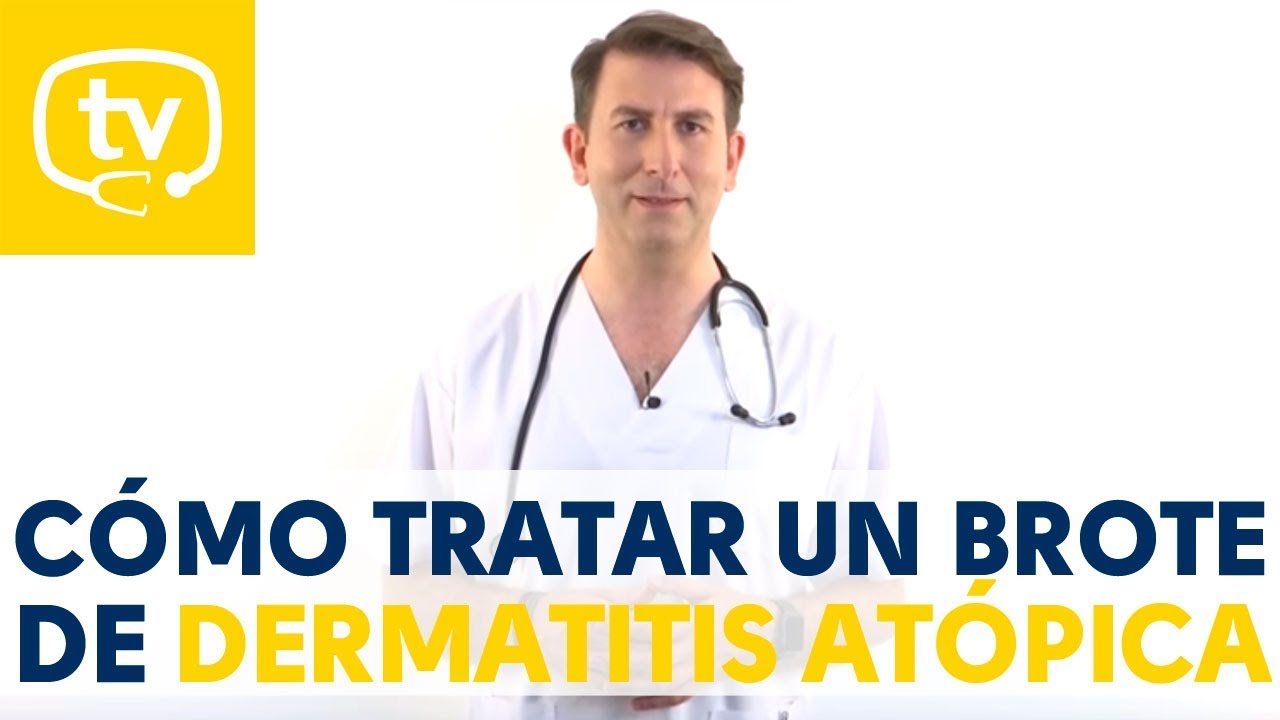 El tratamiento de los brotes de dermatitis atópica en niños