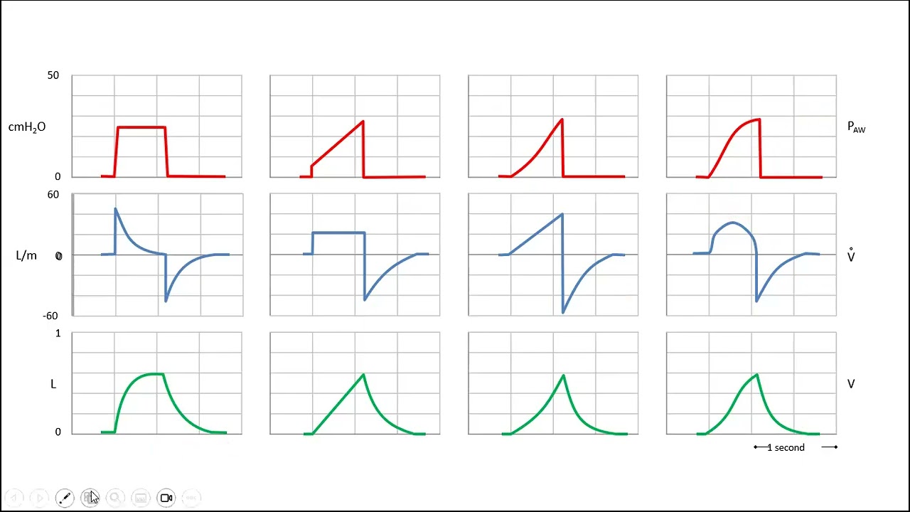 Ventilator graphics