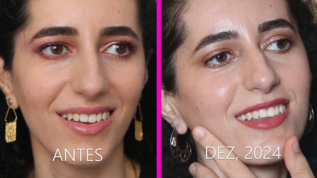 Atualização da Resenha Caneta Clareadora de Dentes Colgate