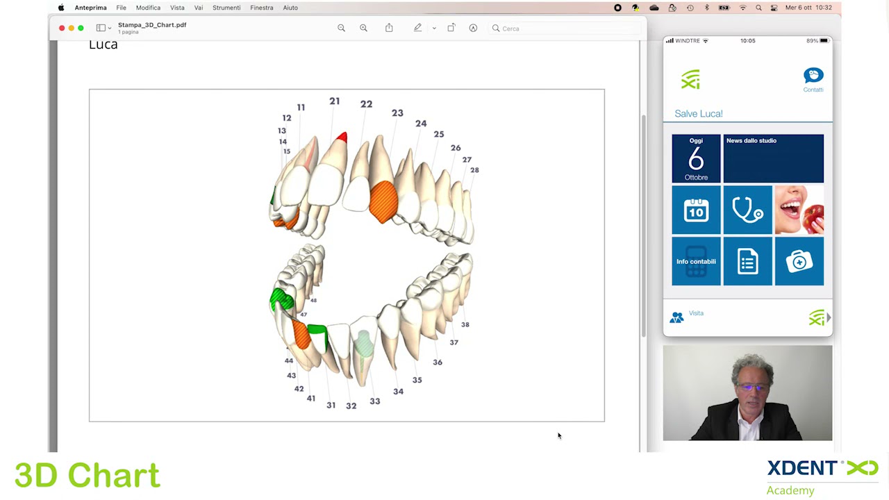 XDENT 3D CHART, LA NUOVA DIMENSIONE DEL PIANO DI CURA