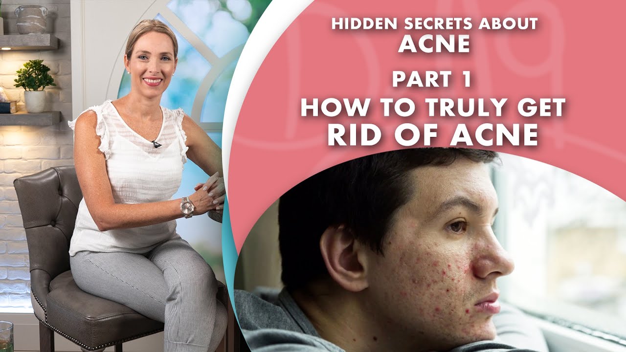 How to Truly Get Rid of Acne Naturally - Dr J9 Live