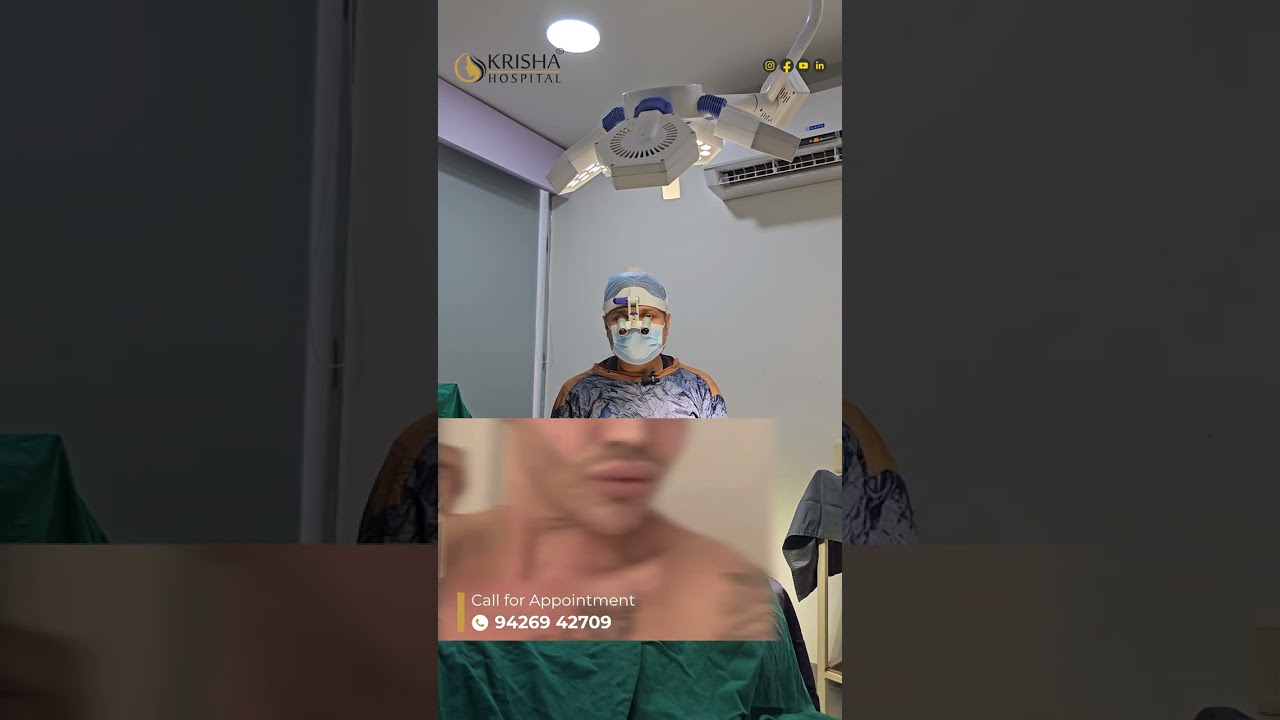 Beard transplant understanding the risks and benefits 