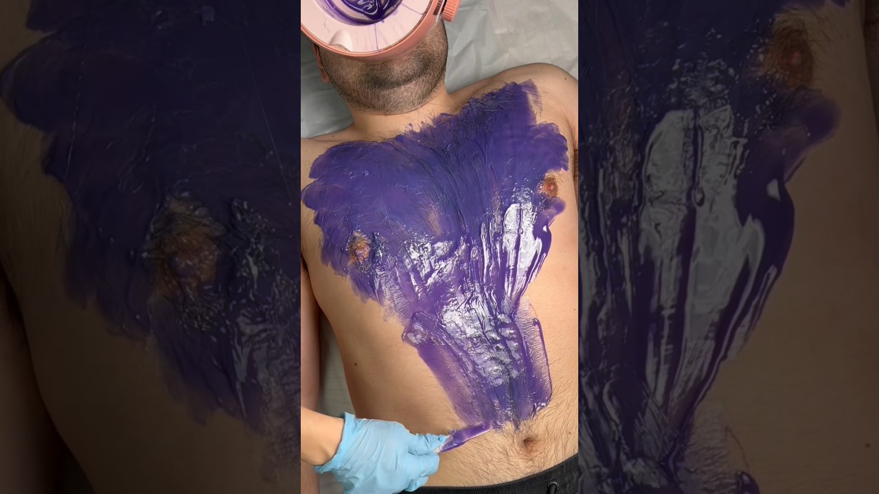 Crazy Chest Wax 🙈 #waxingathome #hairremoval #wax #waxkit #hardwax #chestwax