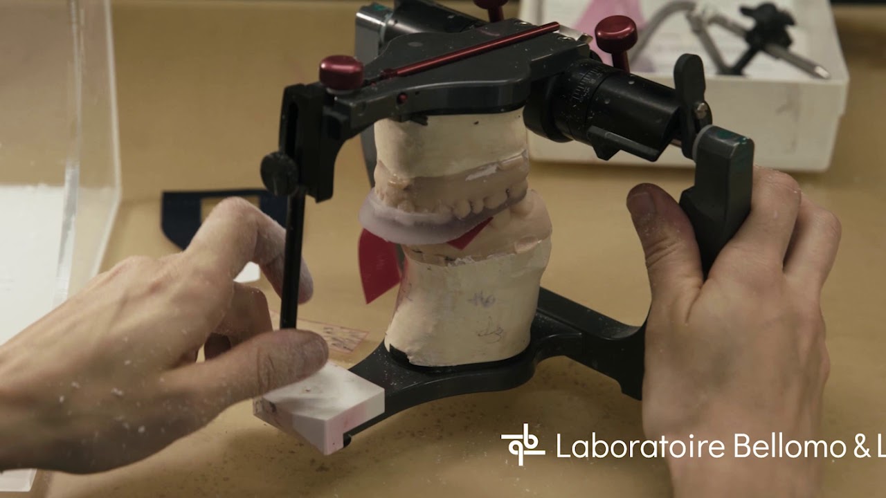 Formation pour dentistes : Comment équilibrer une plaque occlusale