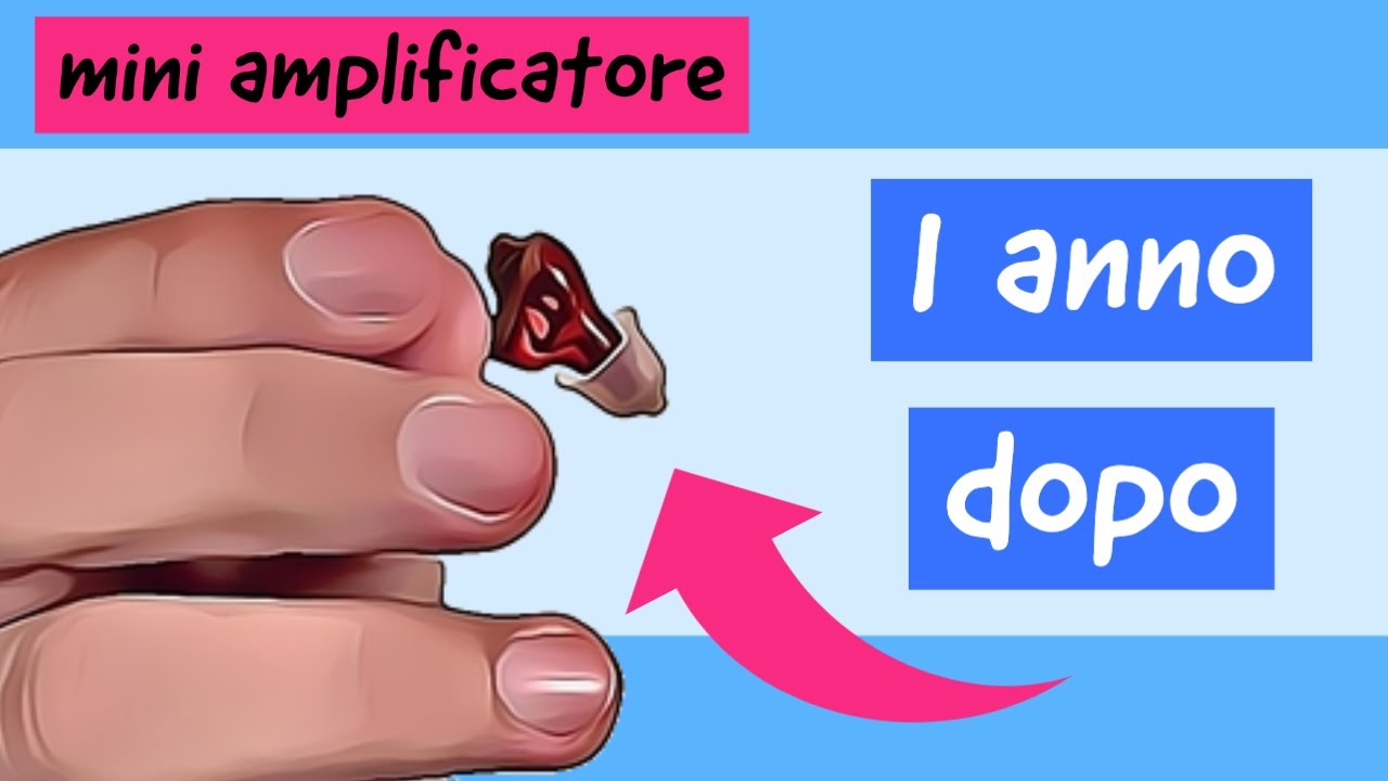 Dopo un anno, mini amplificatore dell'udito contro mini apparecchio acustico invisibile AudioNova