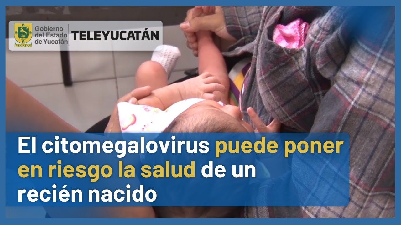 ▶El CITOMEGALOVIRUS en BEBÉS RECIÉN NACIDOS puede ser CONTAGIADO por sus PADRES 👶 | TELE Yucatán