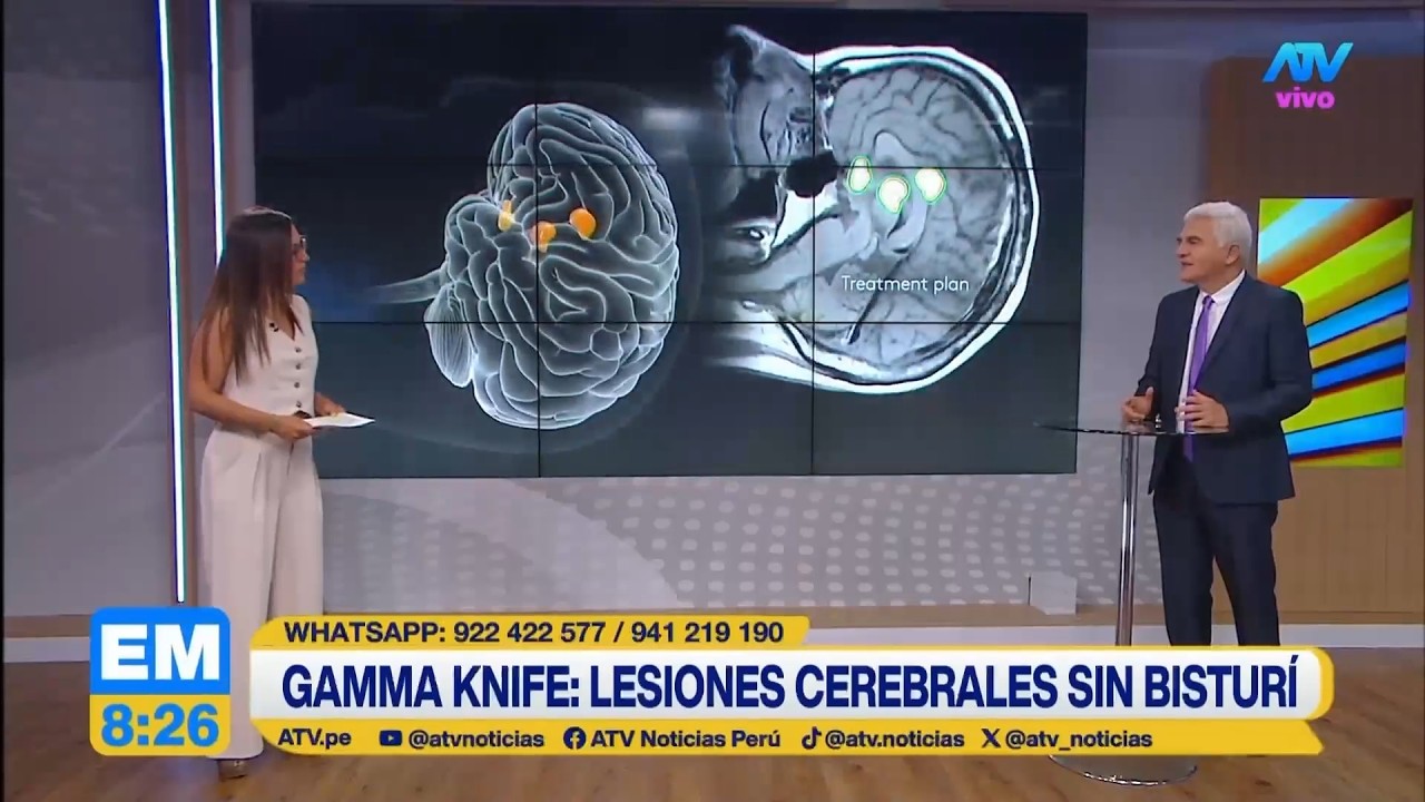 🧠✨ ¿Operar el cerebro sin abrirlo?