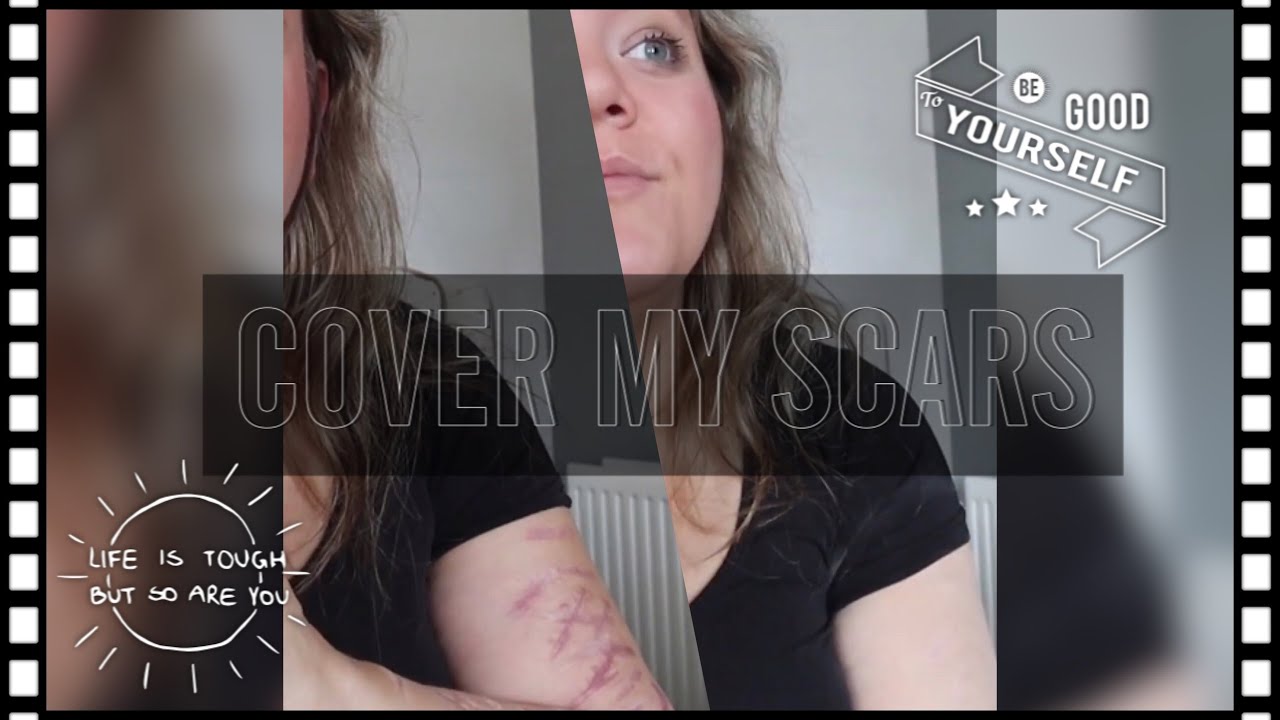 COVER MY SCARS - Hoe ik mijn littekens cover! ANNICK BOX