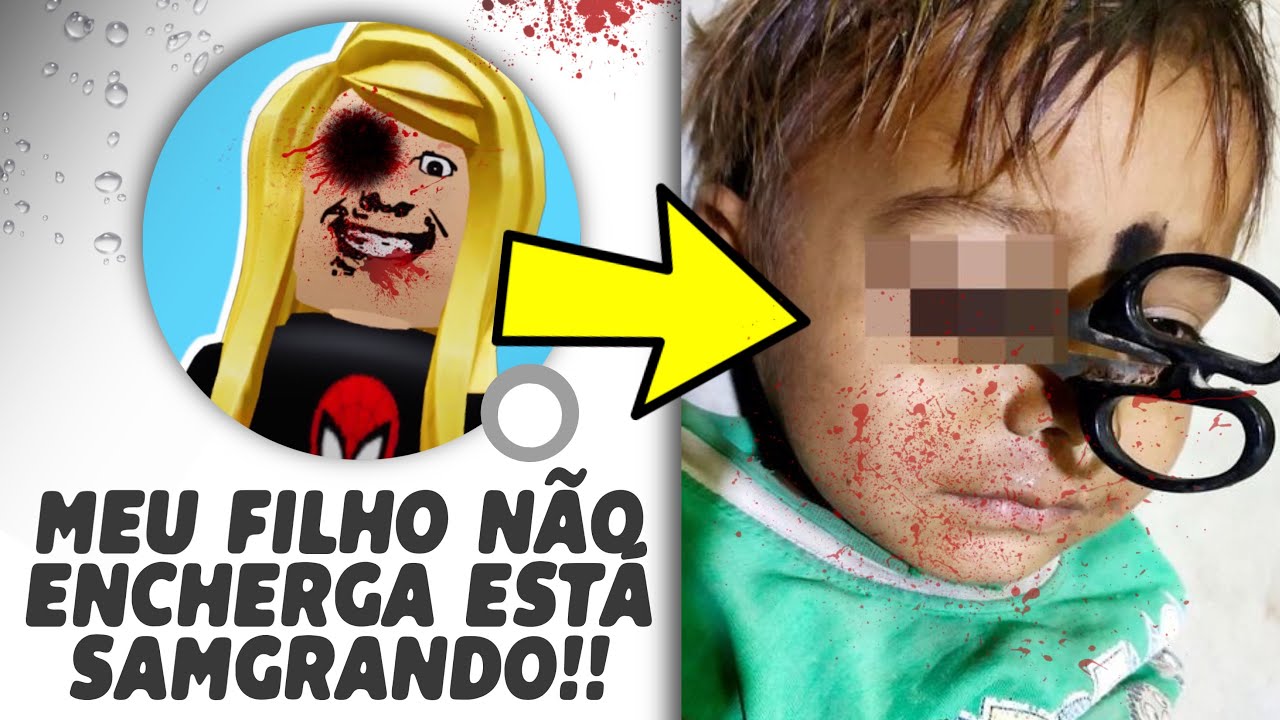 ESTA MÃE FUR0U O OLHO DO FILHO POR CAUSA DE 25 ROBUX… MEU DEUS 😰😱