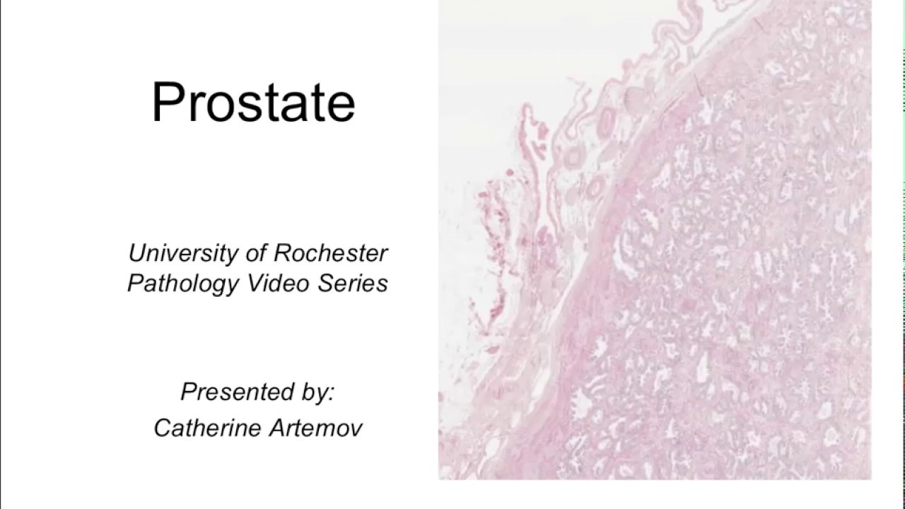 Histology of the Prostate