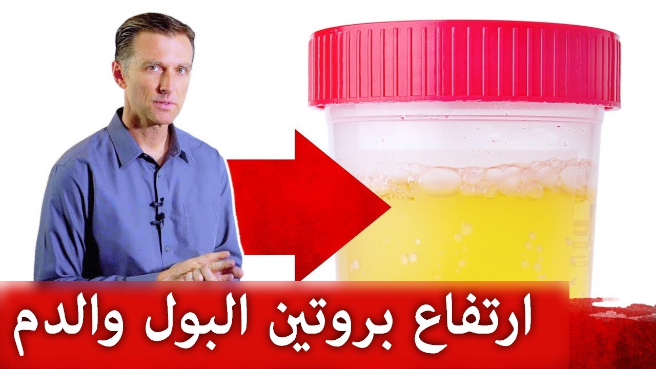 ماذا يدل وجود البروتين في البول والدم | هام جدا