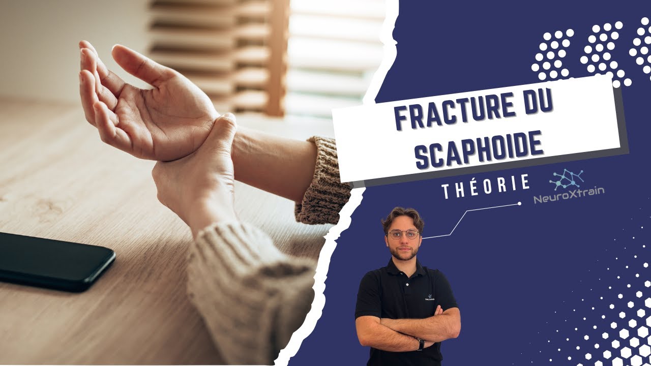 Tu veux en SAVOIR PLUS sur la FRACTURE DU SCAPHOÏDE ? - EN THÉORIE