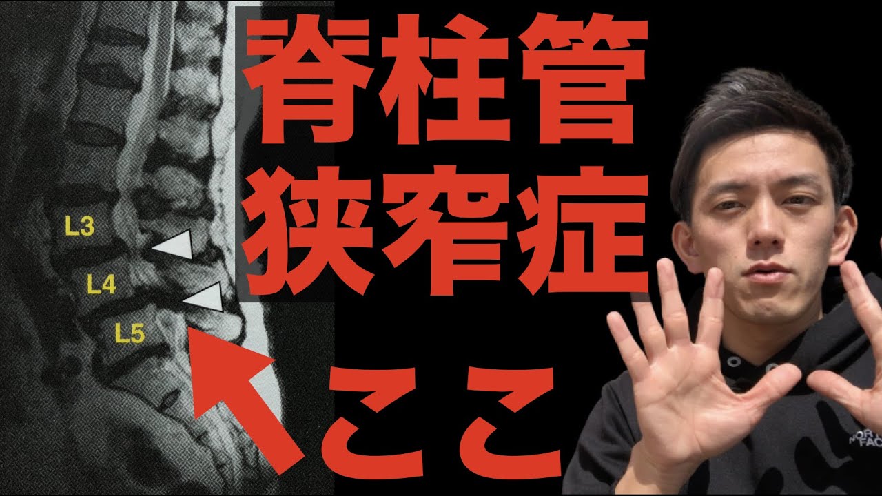 これ↑知らないから治せない！脊柱管狭窄症の”本当”のメカニズム