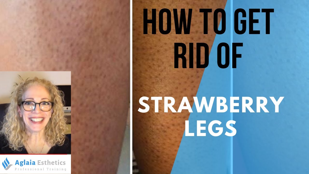 SAY GOODBYE TO STRAWBERRY LEGS!