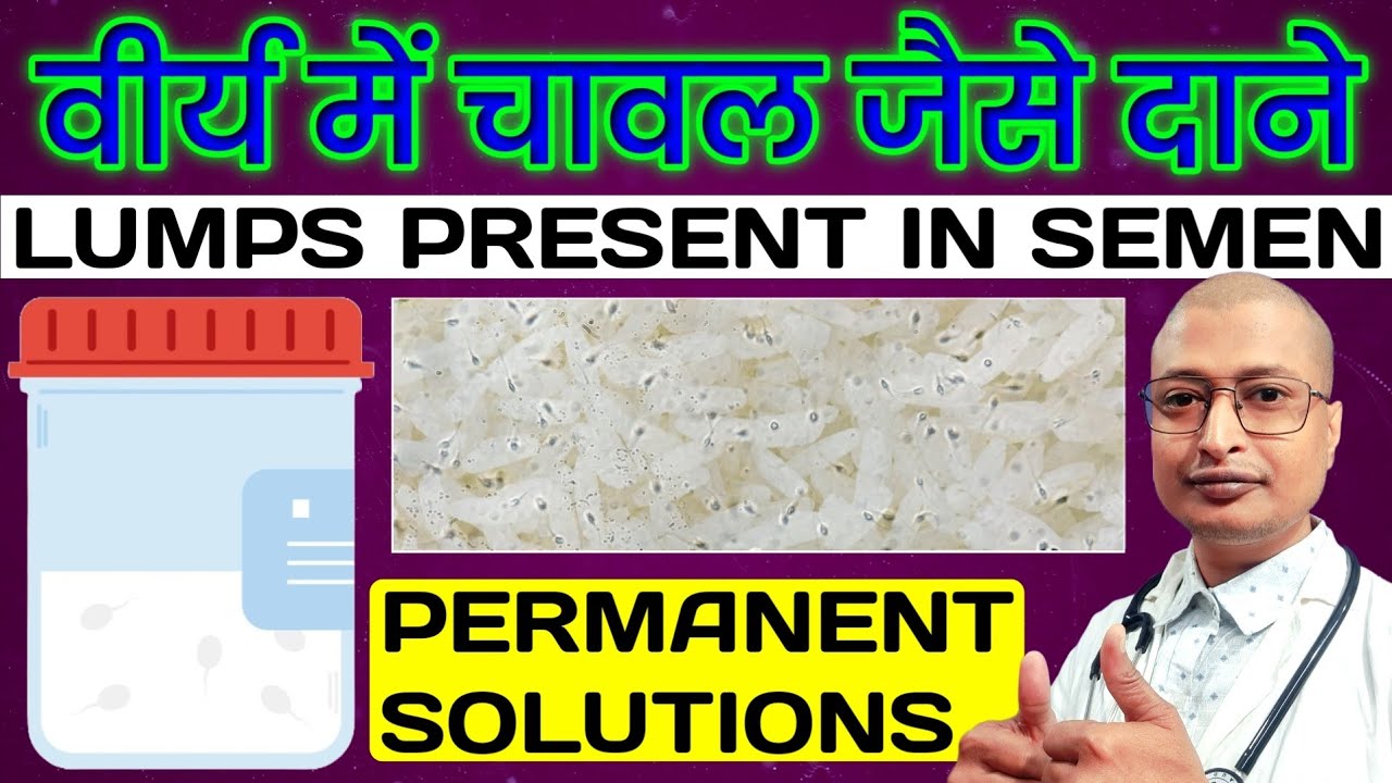वीर्य में चावल जैसे दाने का Permanent Solution | वीर्य में गांठे गुठली का Treatment | Lumps In Semen