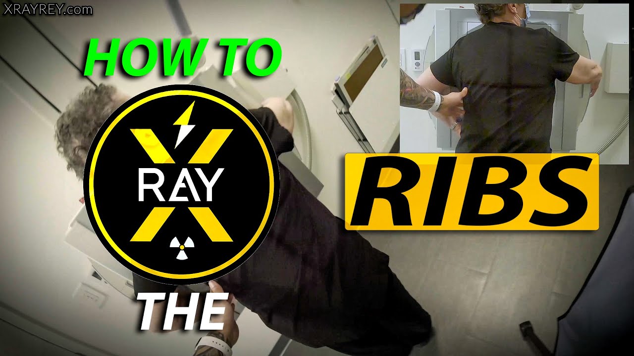HOW TO X-RAY the RIBS | unilateral | bilateral | lower | PA chest | radiology program | positioning