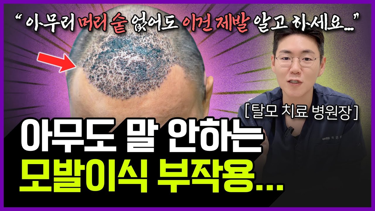 모발이식을 하면 안되는 7가지 경우 