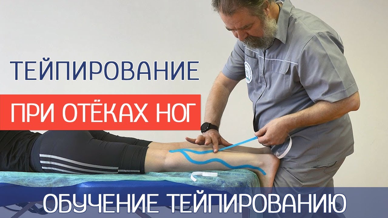 Тейпирование при отеках ног.  Базовый курс тейпирования.