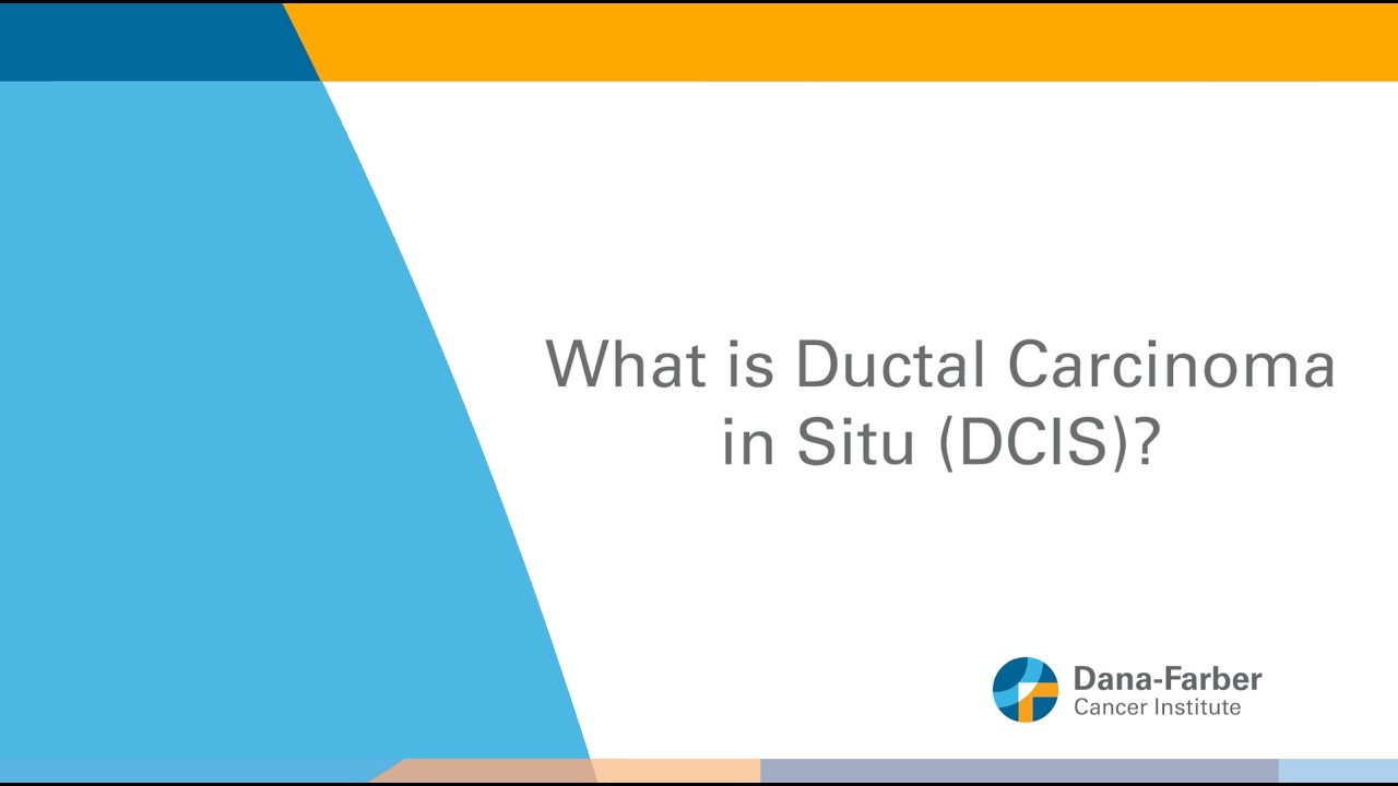 What is Ductal Carcinoma In Situ (DCIS)? | Dana-Farber Cancer Institute
