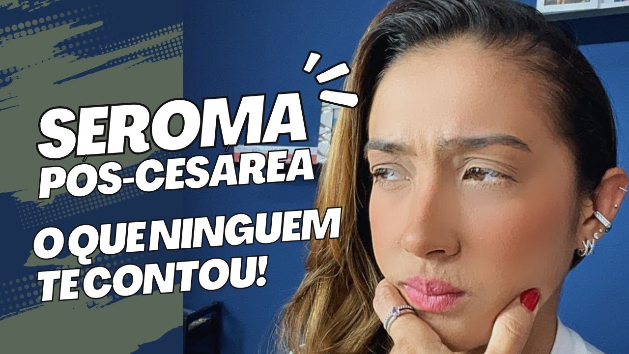 Seroma Pós-Cesárea  - O que é ? Como identificar e quando intervir!