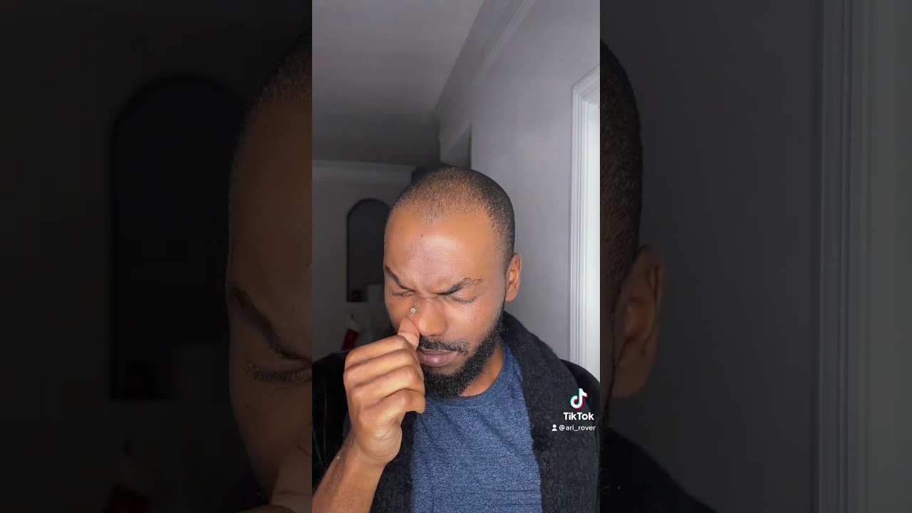 Removing oil in my nose part 15 | NOSE PIMPLE & BLACKHEADS FREE!