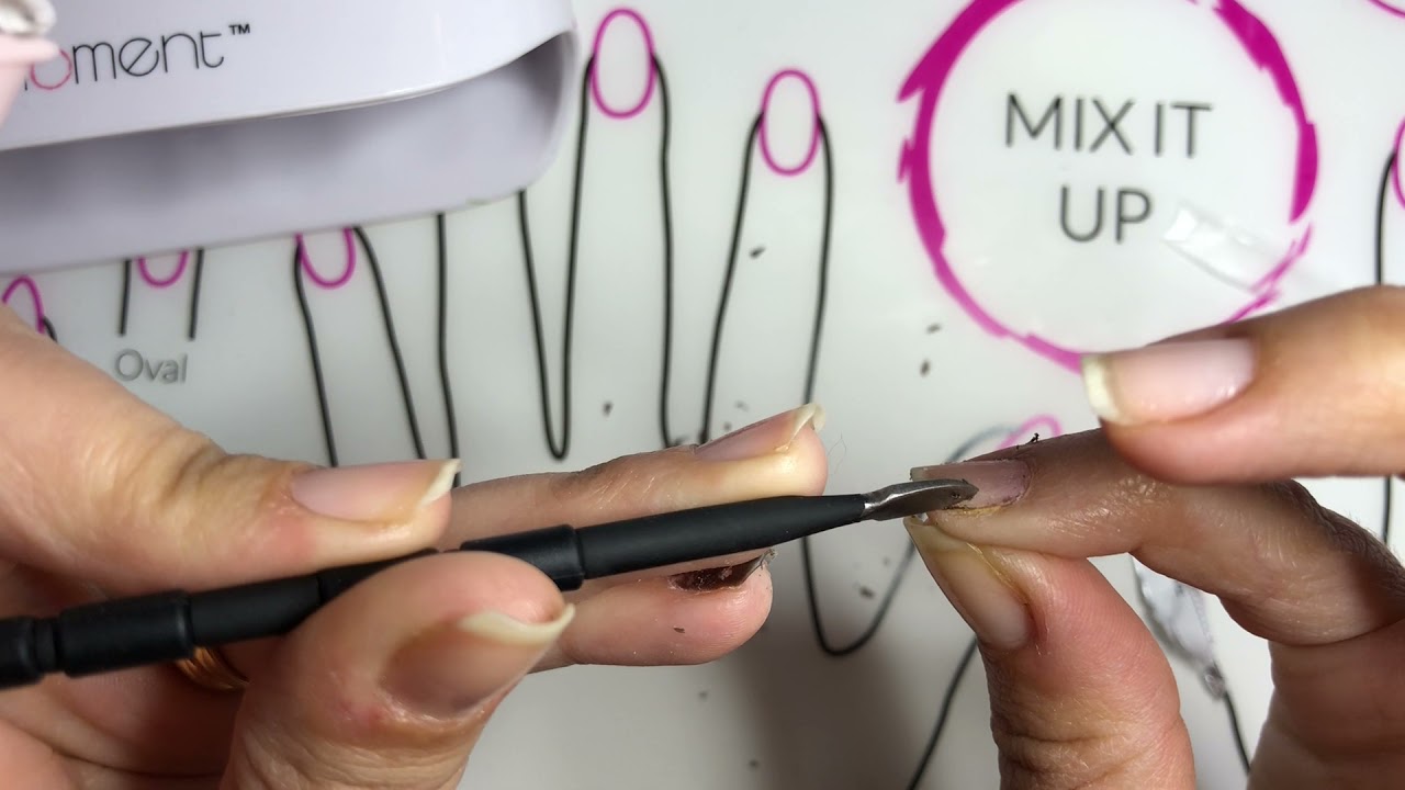 GelMoment removal; with and without fortify