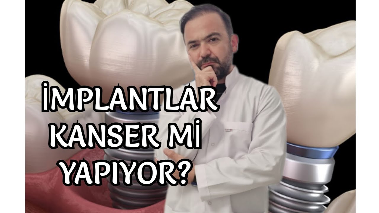 Diş implantları kanser mi yapıyor? Bilimsel veriler ışığında cevapladık.