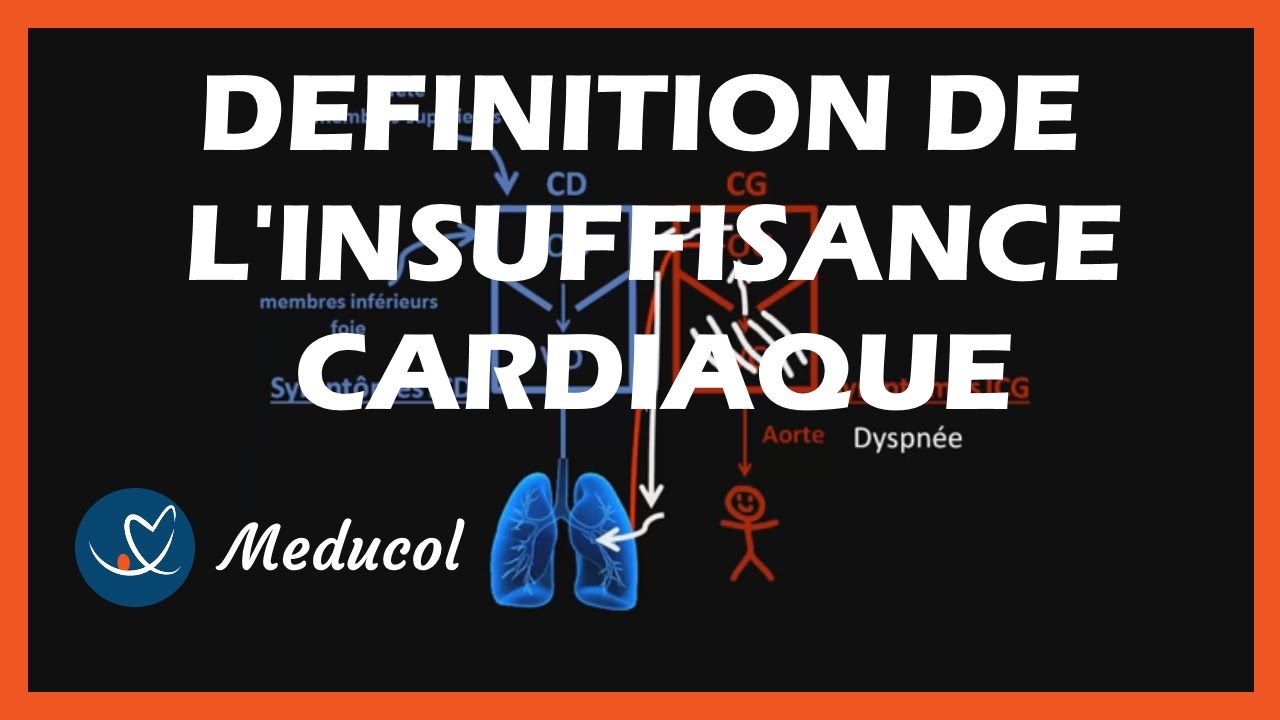 l'Insuffisance Cardiaque : C'est quoi l'insuffisance cardiaque