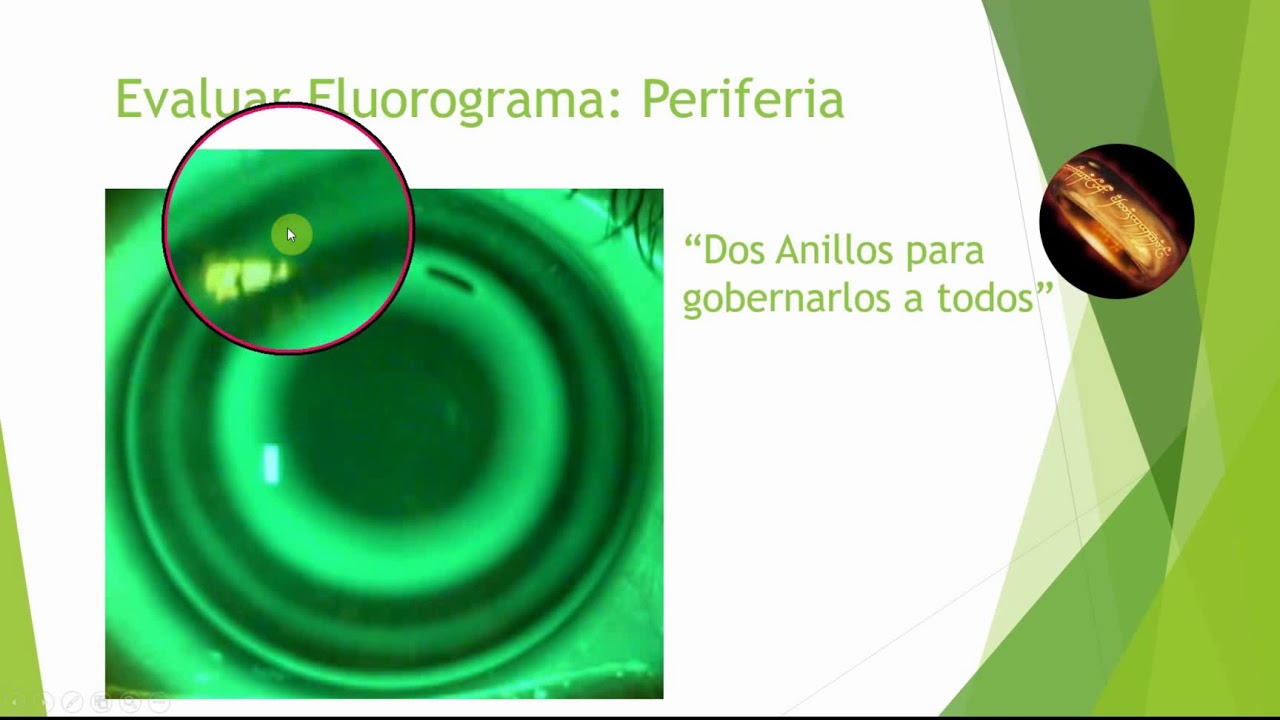 Certificación DRL 4. Fluorograma