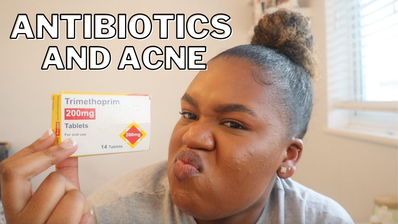 DO I REGRET TAKING ANTIBIOTICS FOR MY ACNE?
