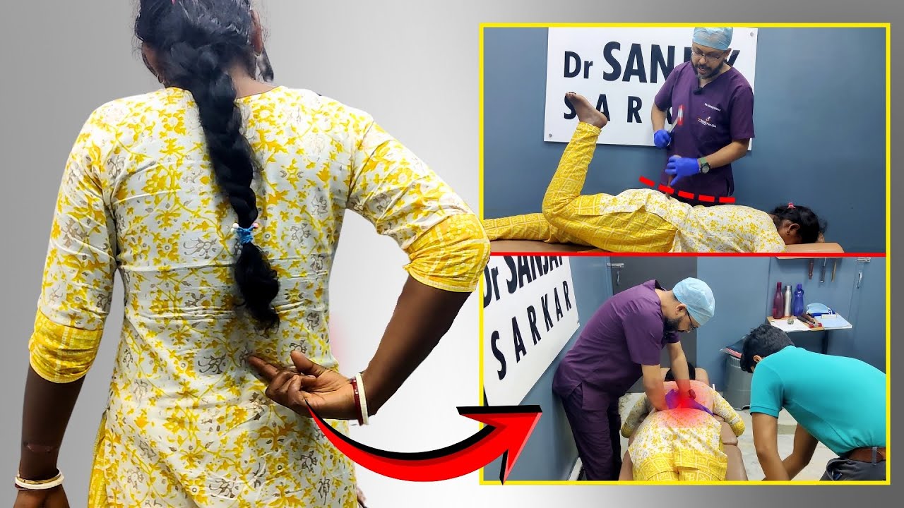 ১ বছর ধরে কোমরের পাশের পেশিতে টান? QL Muscle Spasm Cured by Chiropractor