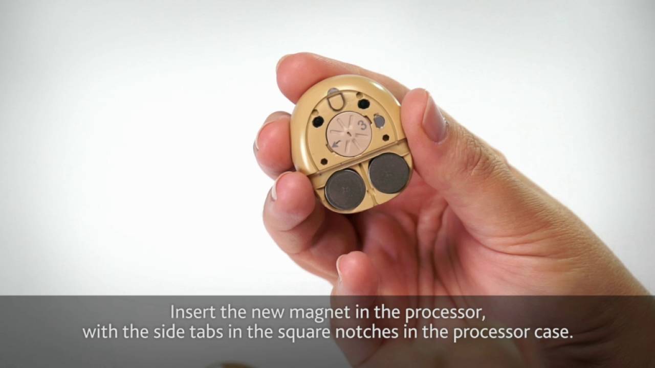Change the Cochlear™ Kanso™ Sound Processor Magnet