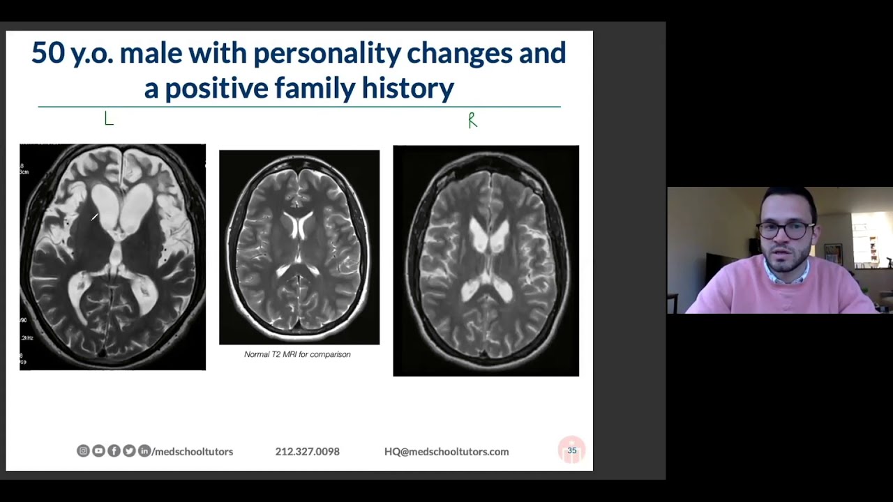 Imaging Differential Diagnosis #2: High Yield Neuro Pathology for the USMLE & COMLEX Exams