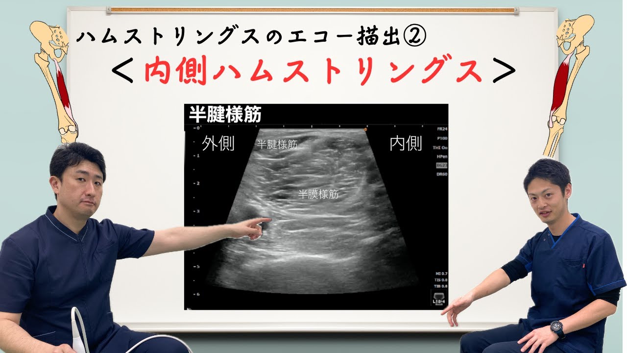 ハムストリングス　エコー描出シリーズ②：内側ハムストリングス