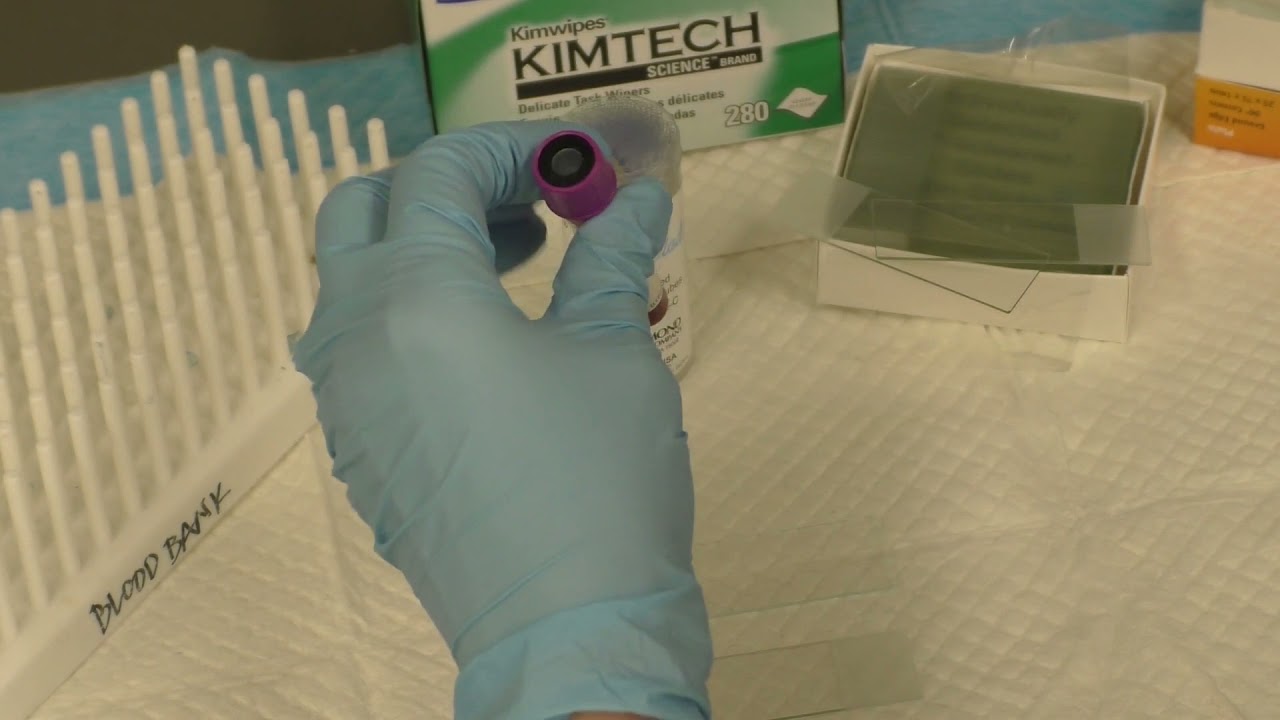 Preparation of a Wedge Smear