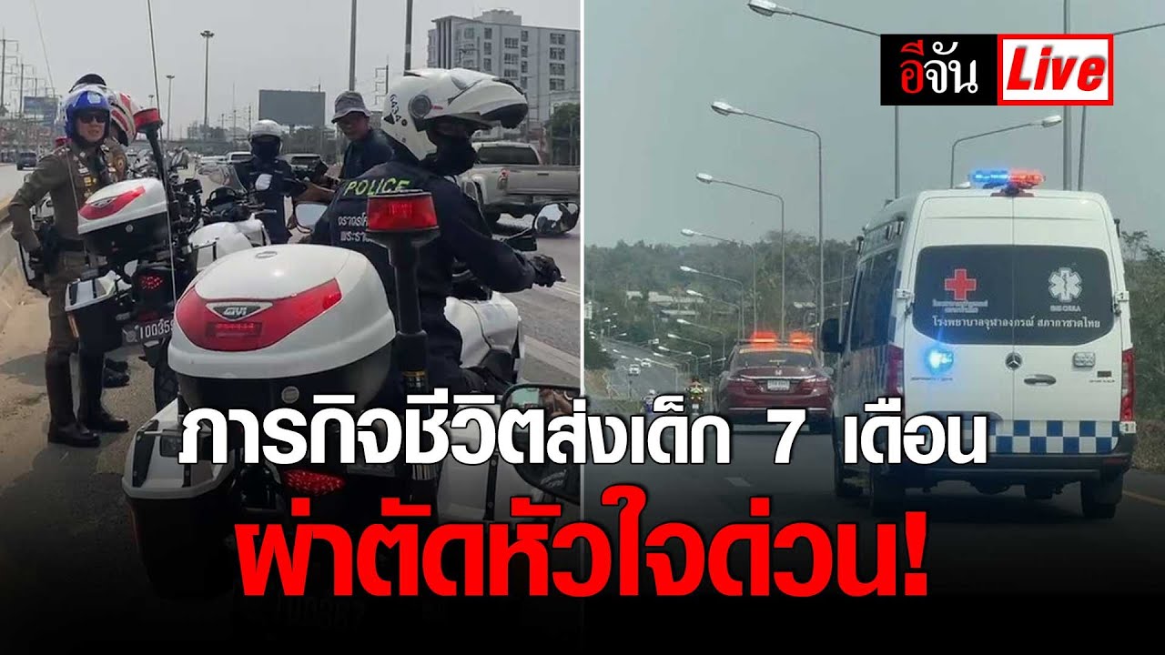 Live ภารกิจชีวิต ส่งเด็ก 7 เดือน ผ่าตัดหัวใจด่วน ! | อีจัน EJAN