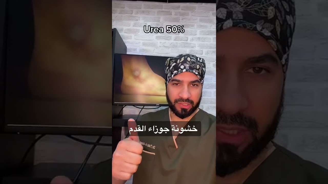 جوزة القدم